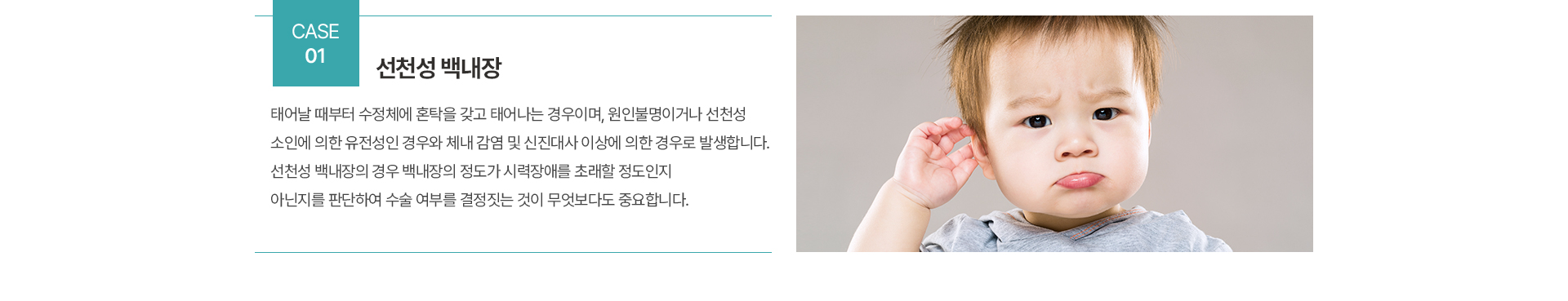 백내장 종류
