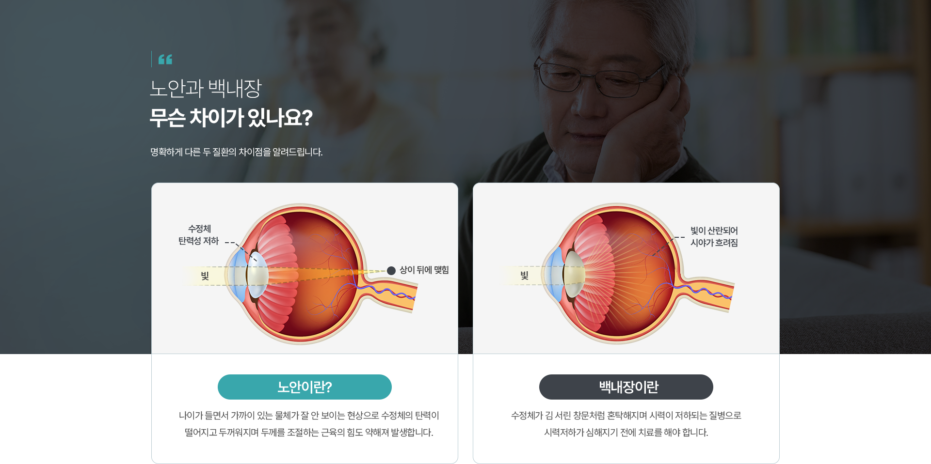노안과 백내장 무슨 차이가 있나요?