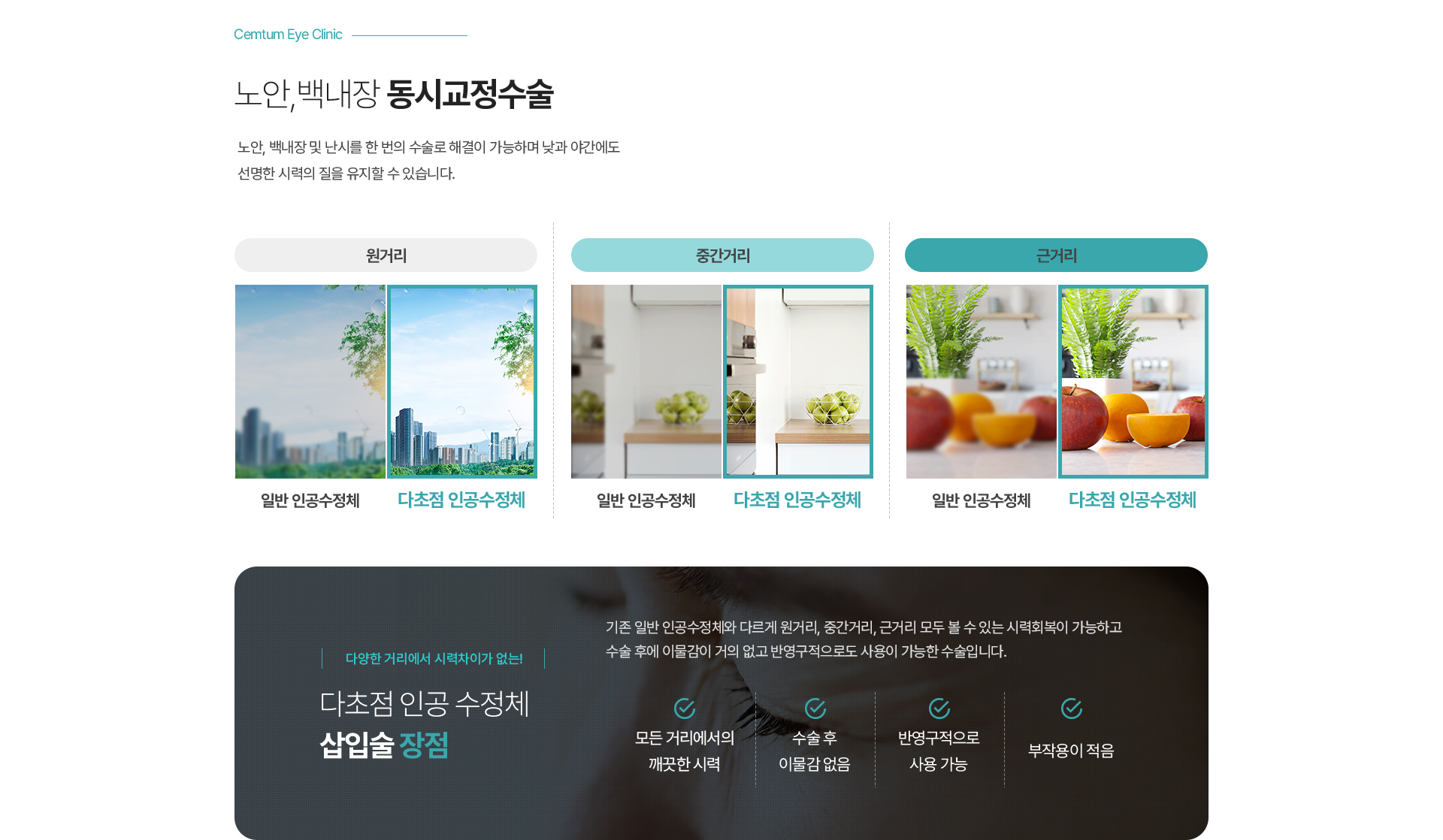 노안,백내장 동시교정수술