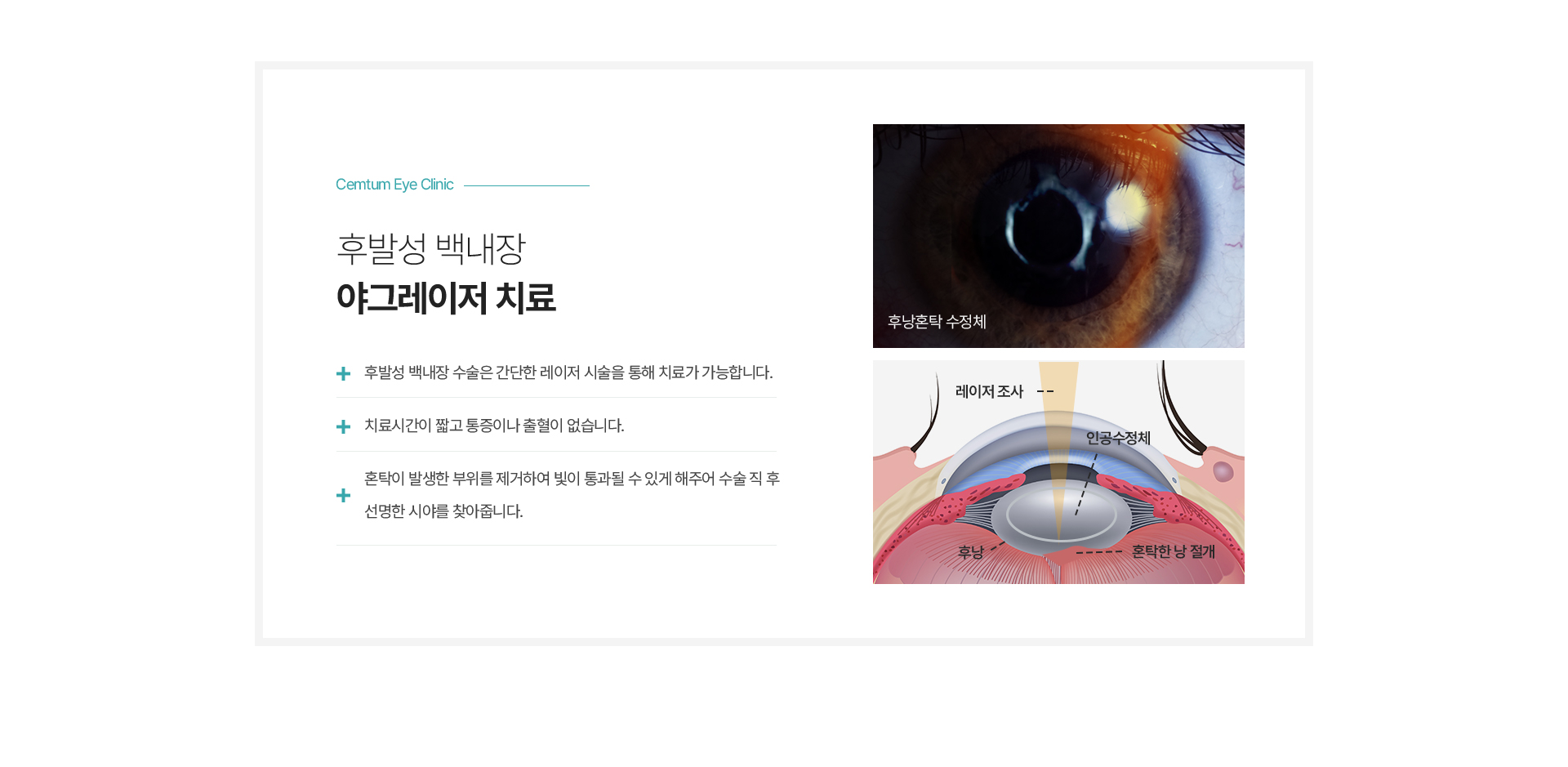 수술 후 주의사항