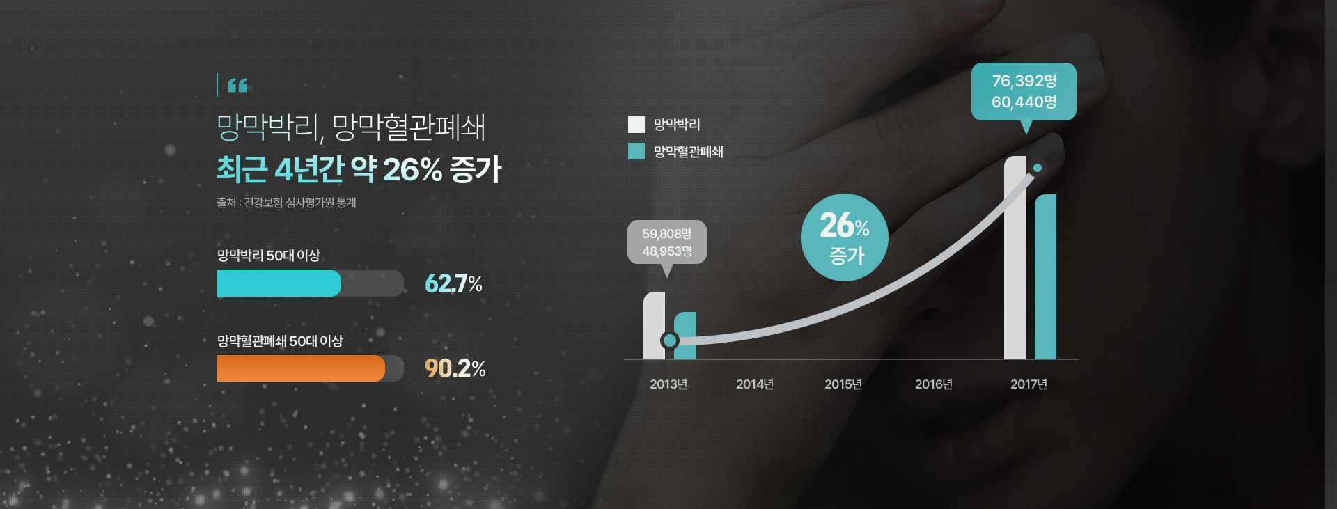 실명 원인질환 TOP3 녹내장 10% 황반변성 15% 당뇨망막증 30%