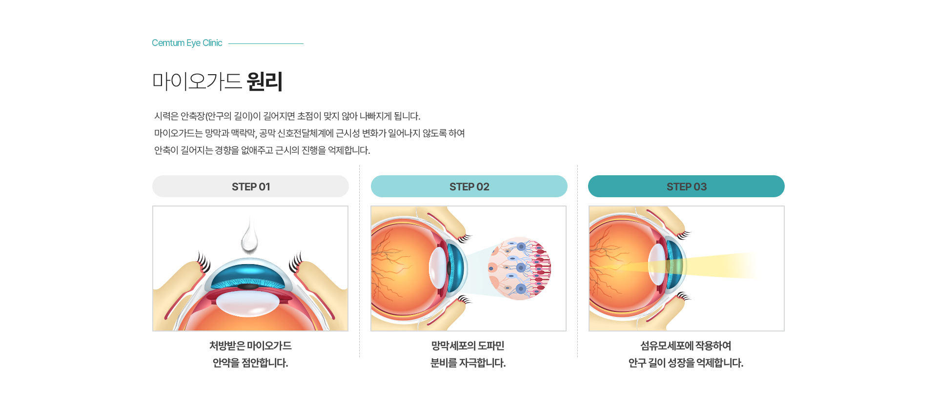 마이오가드 원리