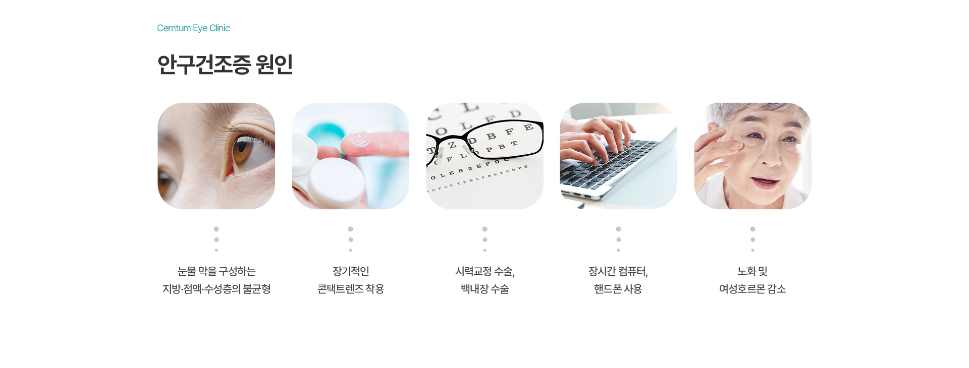 안구건조증 원인