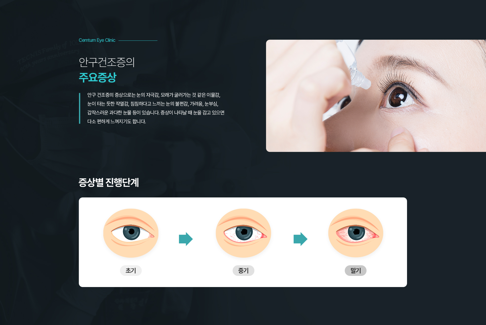 안구건조증의 주요증상