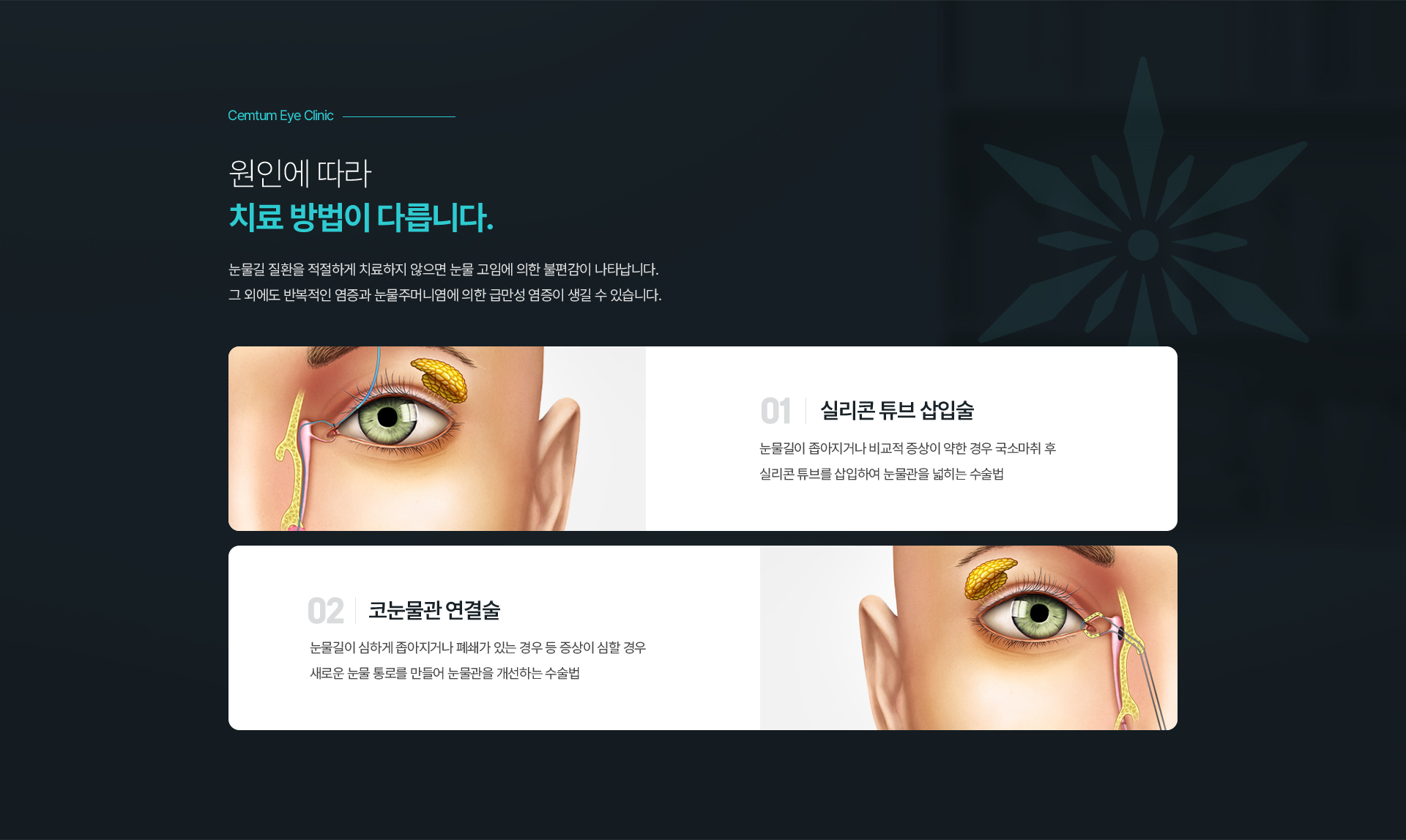 원인에 따라
치료 방법이 다릅니다.
