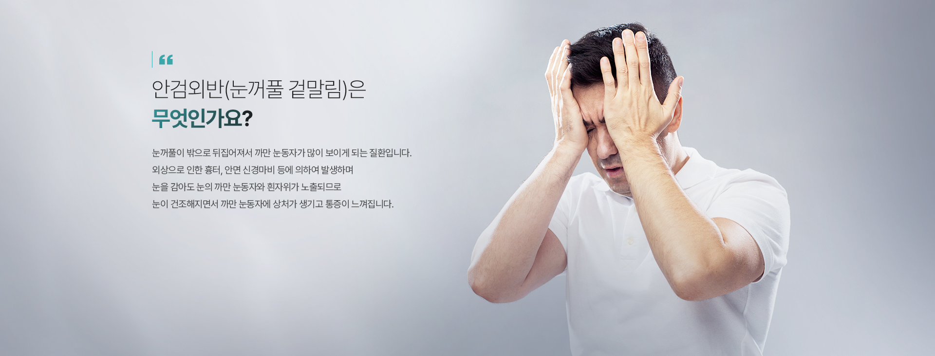 안검외반(눈꺼풀 겉말림)은 무엇인가요?눈꺼풀이 밖으로 뒤집어져서 까만 눈동자가 많이 보이게 되는 질환입니다. 외상으로 인한 흉터, 안면 신경마비 등에 의하여 발생하며 눈을 감아도 눈의 까만 눈동자와 흰자위가 노출되므로 눈이 건조해져서 까만 눈동자에 상처가 생기고 통증이 느껴집니다.